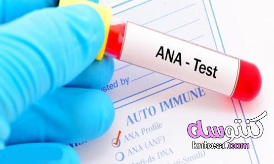 تحليل ANA | لماذا يطلب الطبيب تحليل الأجسام المضادة للنواة