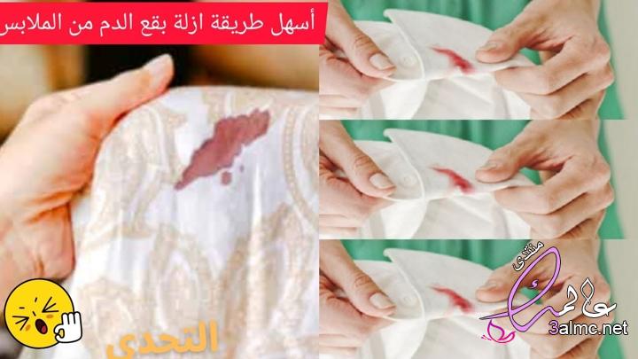 كيفية إزالة بقعة الدم من الملابس